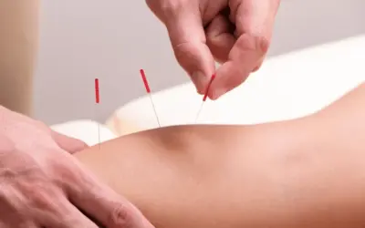 Pain Worse After Dry Needling? Here’s What You Need to Know