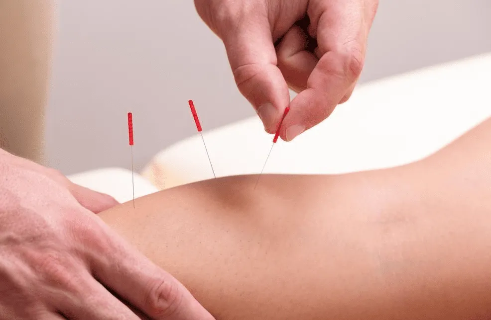 Pain Worse After Dry Needling