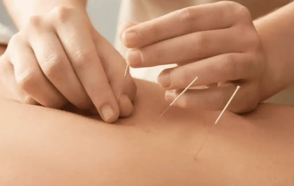 Can Dry Needling Cause Diarrhea