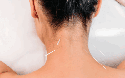 Can Dry Needling Make Pain Worse?