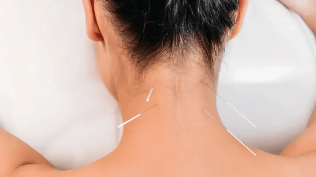 Can Dry Needling Make Pain Worse