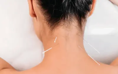 Can Dry Needling Make Pain Worse?