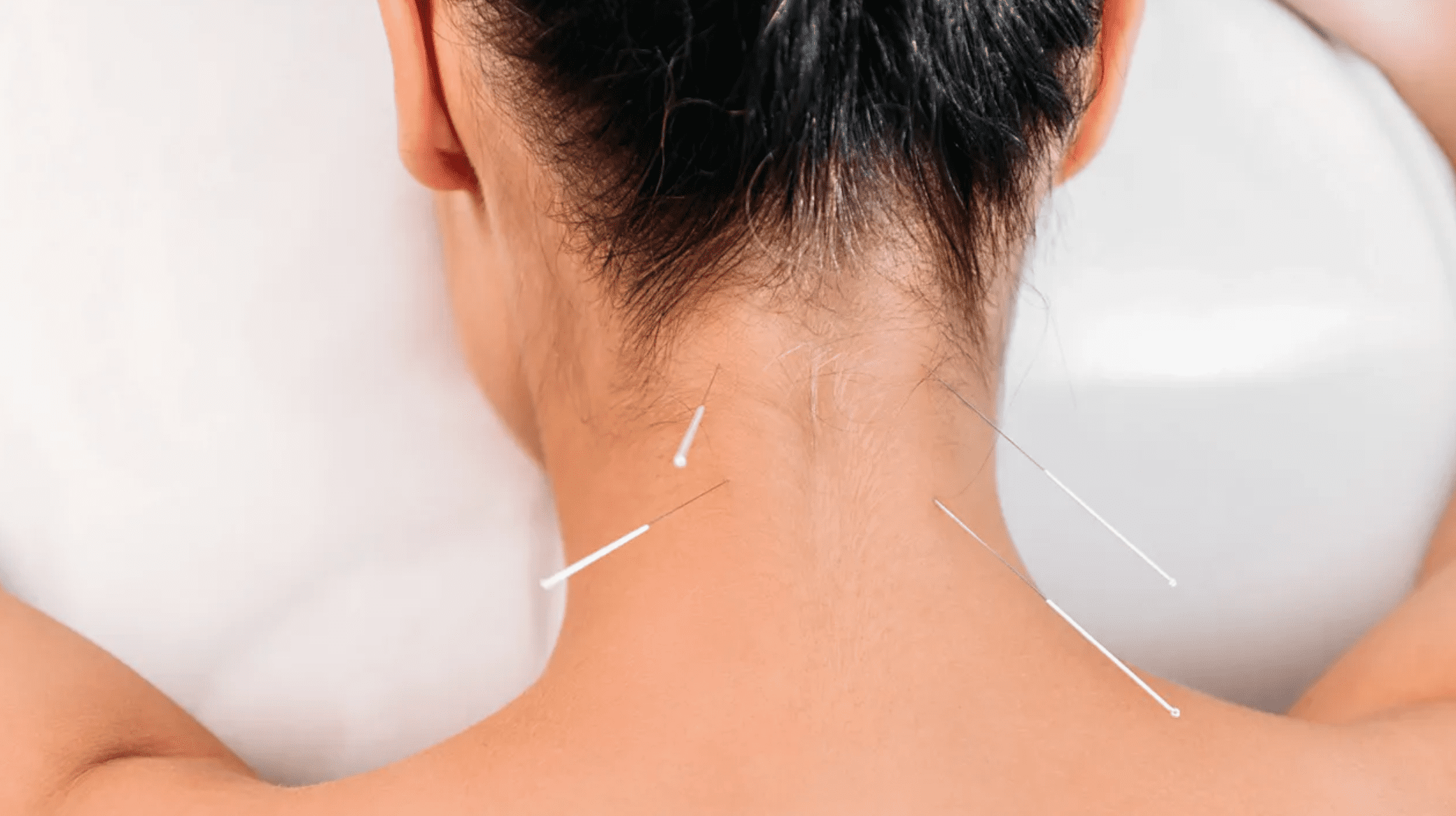 Can Dry Needling Make Pain Worse